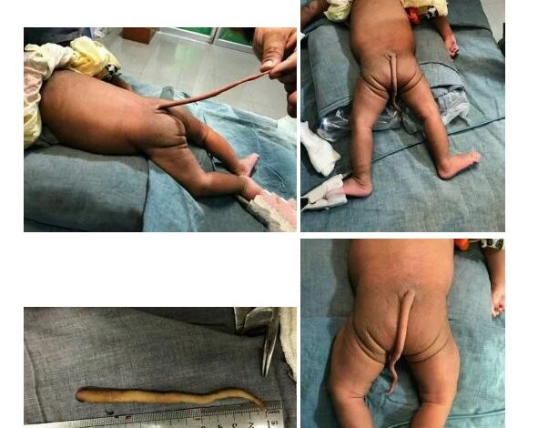 Bebe com cauda.jpg