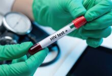 Vecteezy gloved hands holding a test tube with a positive hiv blood 6724302 scaled.jpeg