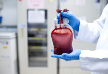Vecteezy doctor s hand holding blood bag in laboratory technician 24263308 scaled.jpg