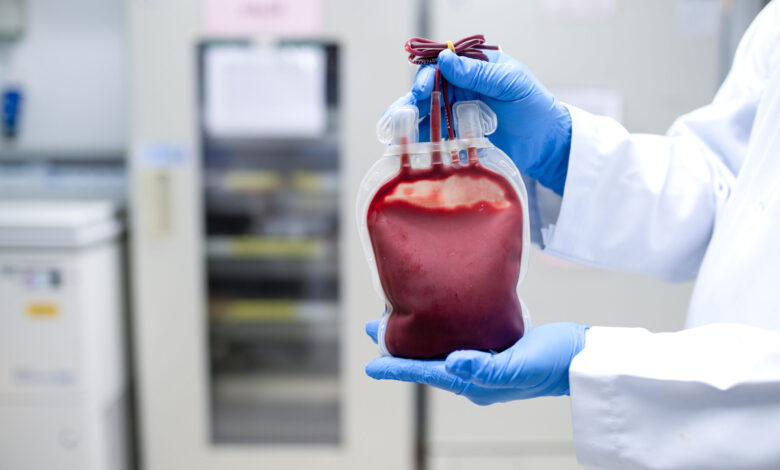 Vecteezy doctor s hand holding blood bag in laboratory technician 24263308 scaled.jpg